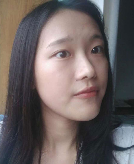 張同學(xué)